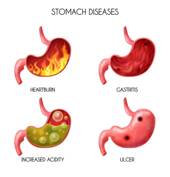 Conjunto de ícones de estômago de órgão interno humano realista — Vetor de Stock