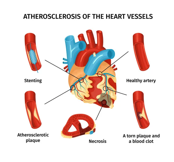 Kalp Anatomisi Bilgileri — Stok Vektör