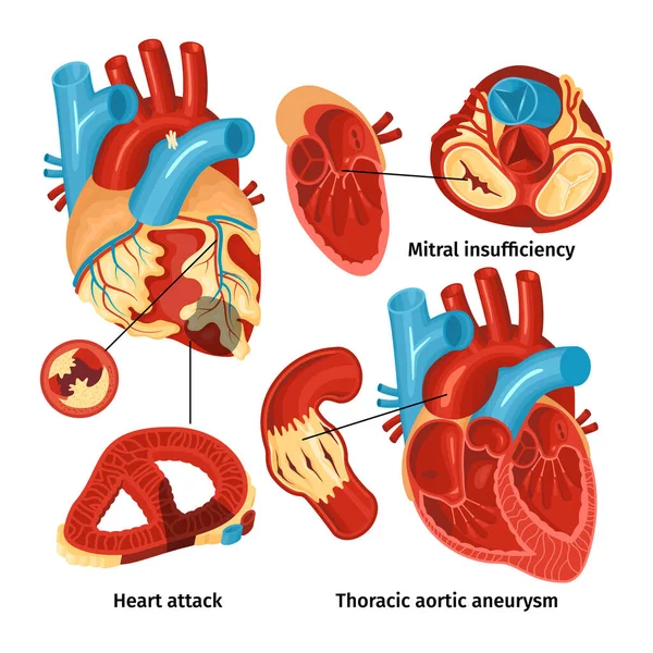 Set di anatomia del cuore — Vettoriale Stock