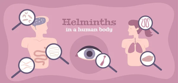 Helminth Worms afiche plano — Vector de stock