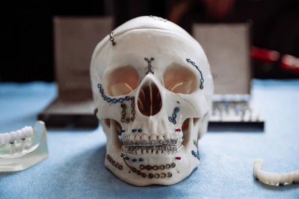 Műanyag modell a koponya fogászati és maxilloarcplasztika. — Stock Fotó