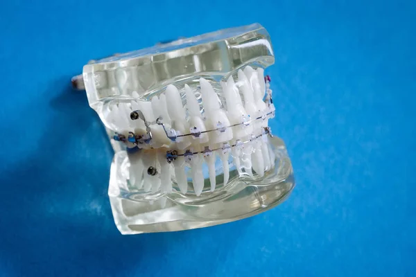 Stomatoloji ve maksimum çene ameliyatı için plastik çene modeli.
