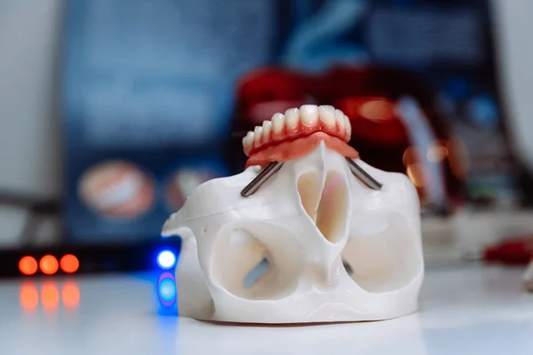 Plastic model of the skull for stomatology and maxillofacial surgery. — Stock Photo, Image