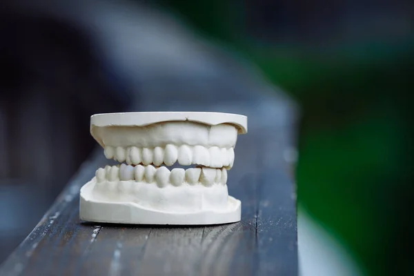 Műanyag állkapocs modell fogászati és maxilloarc műtét. — Stock Fotó
