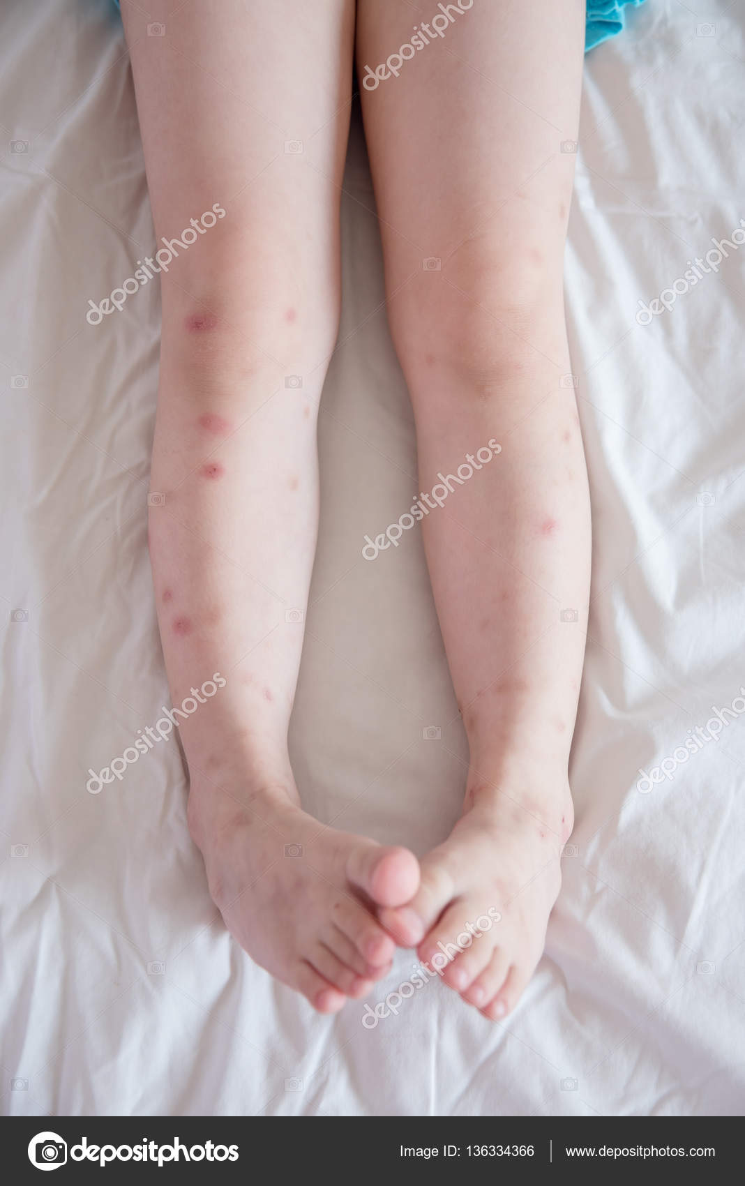 Bebe Moustique Images Libres De Droit Photos De Bebe Moustique Depositphotos Bebe Moustique Images Libres De Droit Photos De Bebe Moustique Depositphotos