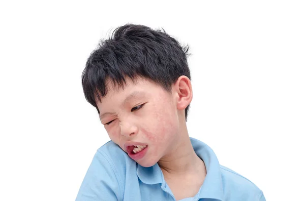 Çocuk yüz beyaz arka plan üzerinde döküntü ile — Stok fotoğraf