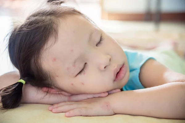 Flicka med fläck på ansikte sover efter få sjuka — Stockfoto