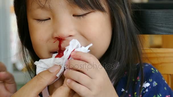 Mãe limpe o nariz sangrando de sua filha — Vídeo de Stock
