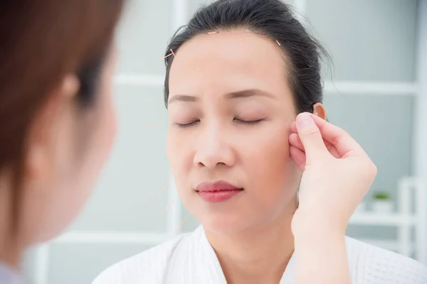 Piękna azjatycka kobieta otrzymywać twarzy akupunktura leczenie w klinice — Zdjęcie stockowe