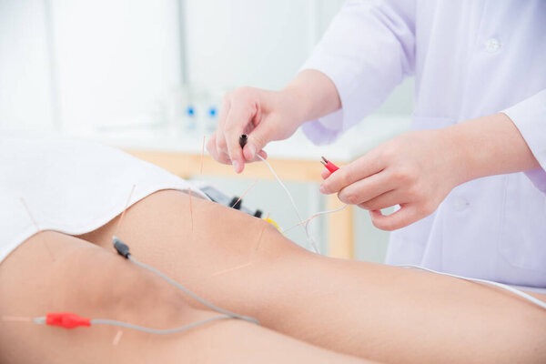 Close up of acupuncturist hands doing acupuncture with electrical stimulator at patient leg