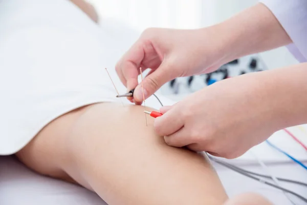 Close-up van acupuncturist handen doen acupunctuur met elektrische stimulator bij patiënt been — Stockfoto
