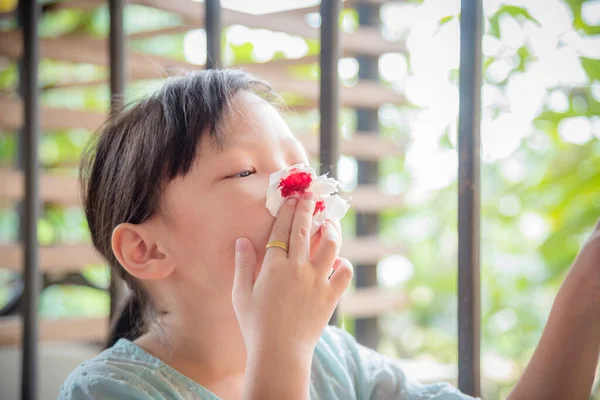 Pequeña niña limpie su nariz sangrante con papel tisú — Foto de Stock