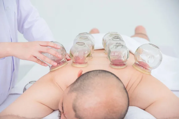 Primo piano di un terapeuta che dà Cupping Trattamento sulla schiena del paziente — Foto Stock