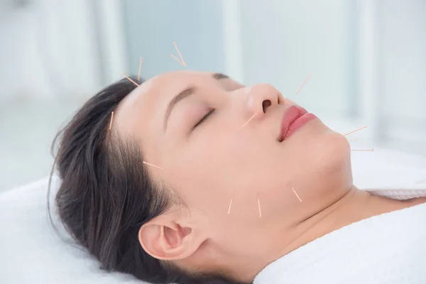 Belle femme asiatique recevant traitement d'acupuncture faciale à la clinique — Photo