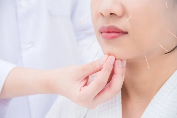 Asijská žena dostává obličejovou akupunkturu léčba na klinice — Stock fotografie