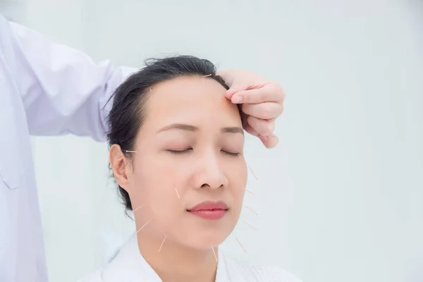 Krásná asijská žena dostává ošetření obličejové akupunktury na klinice — Stock fotografie