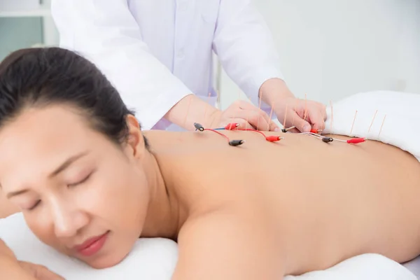 Mooie aziatische vrouw ontvangen terug acupunctuur met elektrische stimulator in kliniek Rechtenvrije Stockfoto's