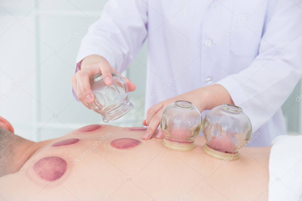 Close-up Of  a Therapist finish Cupping Treatment on patient back
