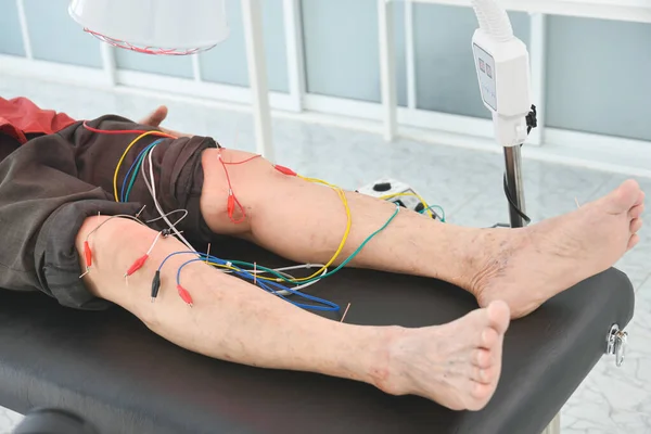膝や足で電気鍼治療を受けて痛みを緩和する男 代替医療の概念 — ストック写真