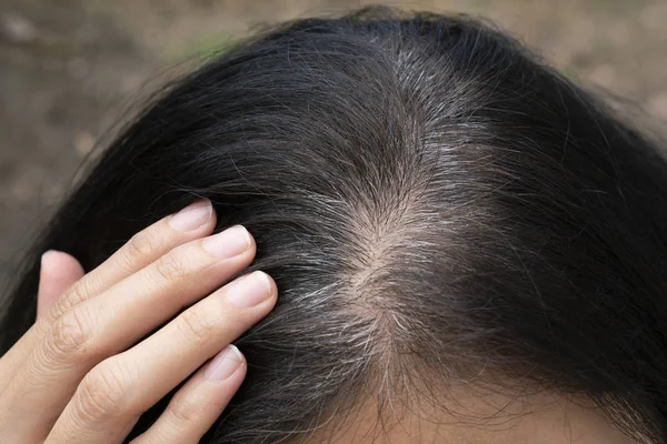 Young woman shows her gray hair roots — Stock Photo, Image