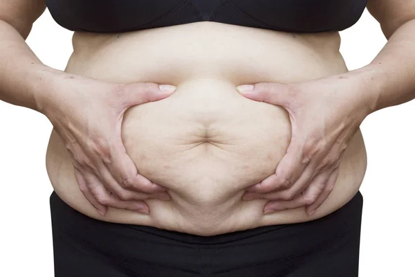 Asyalı kadın göbek üzerinde streç işaretleri