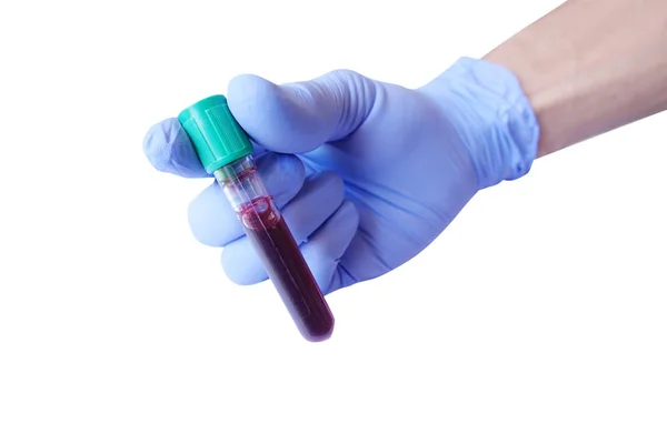 Hand with latex glove holding blood sample — Stock Photo, Image