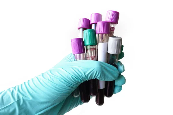 Hand with latex glove holding blood sample — Stock Photo, Image