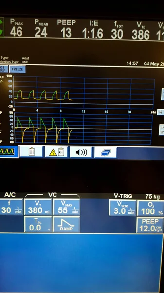 Mechanikus ventilátor vezérlőpaneljének közelsége — Stock Fotó