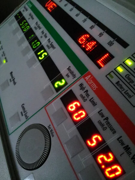Close up of a mechanical ventilator, s control panel — стоковое фото