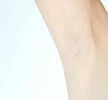 Kadınların beyaz arka planda siyah koltukaltı sorunu vardır.