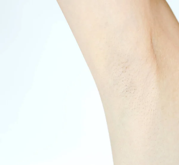 Women Have a problem black armpit on white background — Stock Photo, Image
