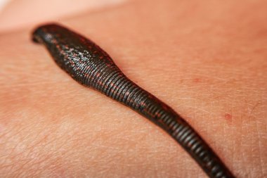 Man's taraftan sülük