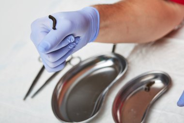 Doktor bir sülük tutar