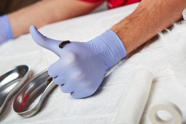 Alternatif Tıp Hirudotherapy 