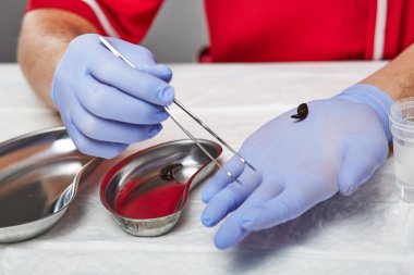 Doktor bir sülük gösterir 