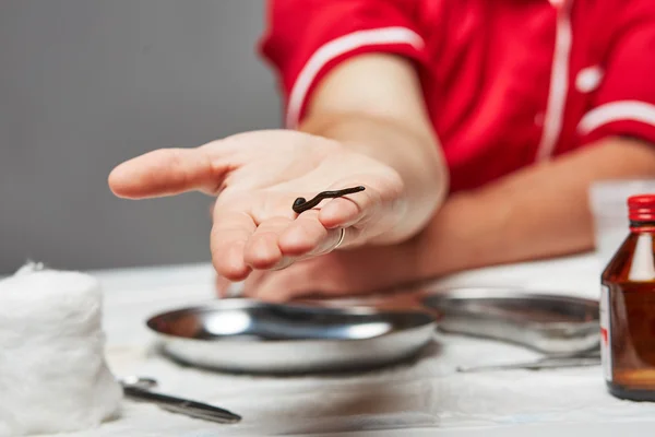 Leech sulla mano del medico — Foto Stock