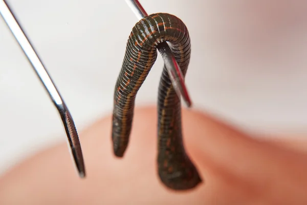 Leech on medical instrument — Stock Photo, Image