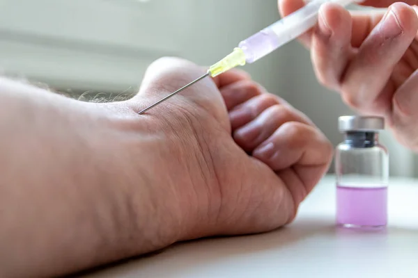 Man gets an injection for local anesthesia to reduce pain in his hand and get a healthy infusion through the injection needle as infusion therapy and cure of sickness