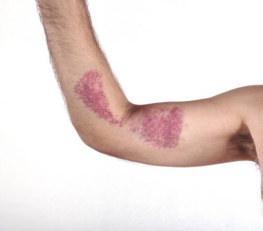 Erkek eli ile hematom beyaz arka plan üzerinde