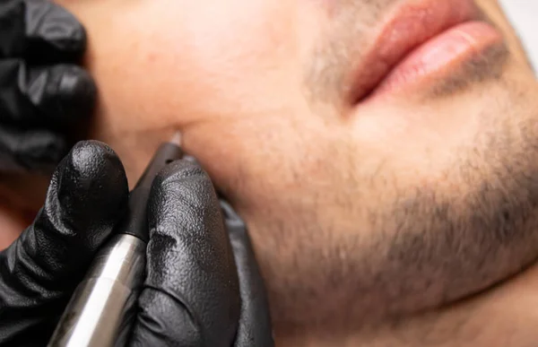 Mannelijke trichopigmentatie service. Jongeman op de rug op de schoonheidsspecialiste tafel. Meester handen in een zwarte handschoenen die de permanente make-up machine met de naald en aanraken van mans haar. — Stockfoto