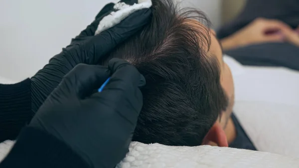 在美容师的理发过程中 一个男人躺在沙发上进行高质量的特写 男性三叉戟服务 头皮微色素沉着治疗 图库照片