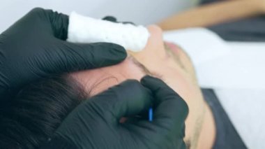 Yüksek kalite yakın çekim 4K yavaş çekim videosu. Estetisyen saç tedavisiyle koltukta yatan bir adam. Erkek tricopigmentasyon servisi. Kafa derisi mikro pigmentasyon tedavisi. Trikopigmentasyon prosedürü.