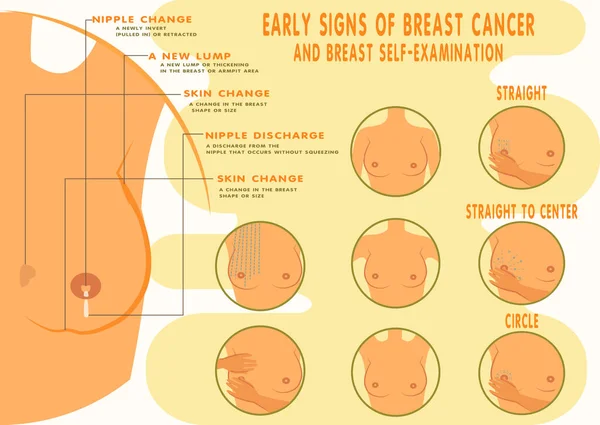 Καρκίνος του μαστού πρώιμη Είσοδος, αυτο-εξέταση Banner. — Διανυσματικό Αρχείο