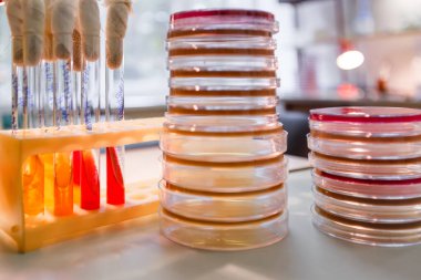 Laboratuvarda kan testleri yapılıyor.