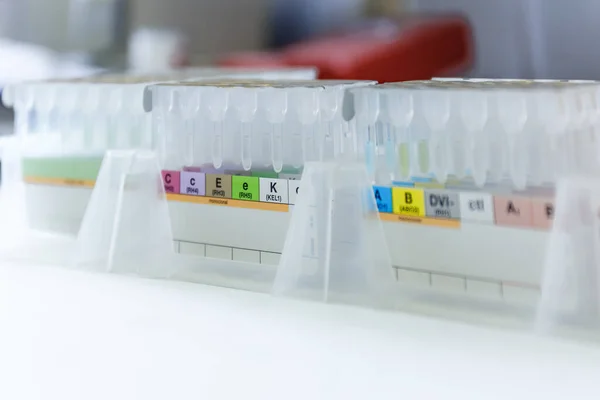 Laboratuvarda kan testleri. Laboratuvar için test tüpü