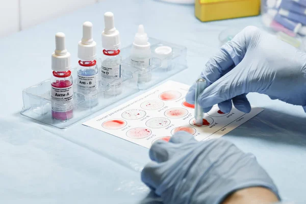 Laboratuvarda kan testleri. Laboratuvar için test tüpü
