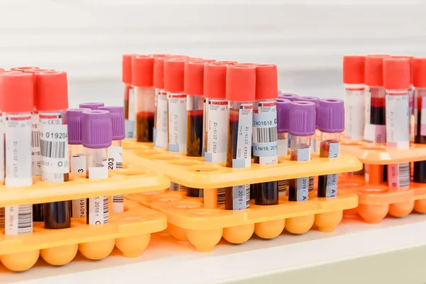 Blood tests in the laboratory. Test tube for laboratory