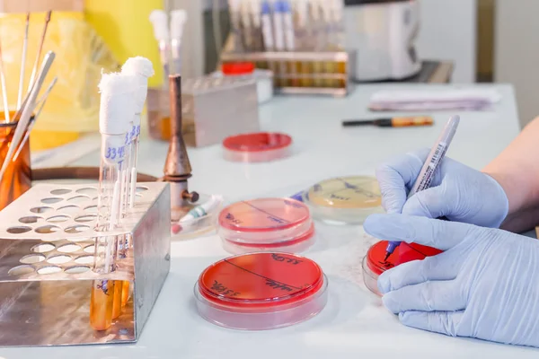 Laboratuvarda kan testleri yapılıyor.