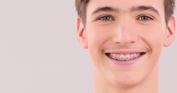歯にブレースをつけて笑顔で若い男 カメラを探しても 健康な歯を持つハンサムな若い男の子 クローズアップビュー リアルタイム映像50Fps Prores 笑顔の人間の顔 — ストック動画