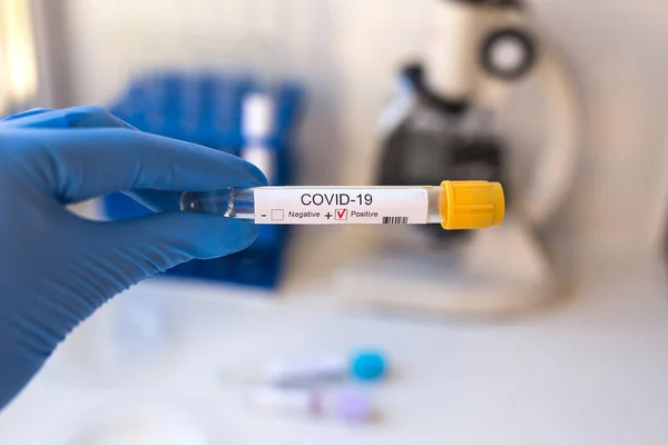 Covid Coronavirus Positief Bloedmonster Gediagnosticeerd Het Ziekenhuis Coronovirustest — Stockfoto